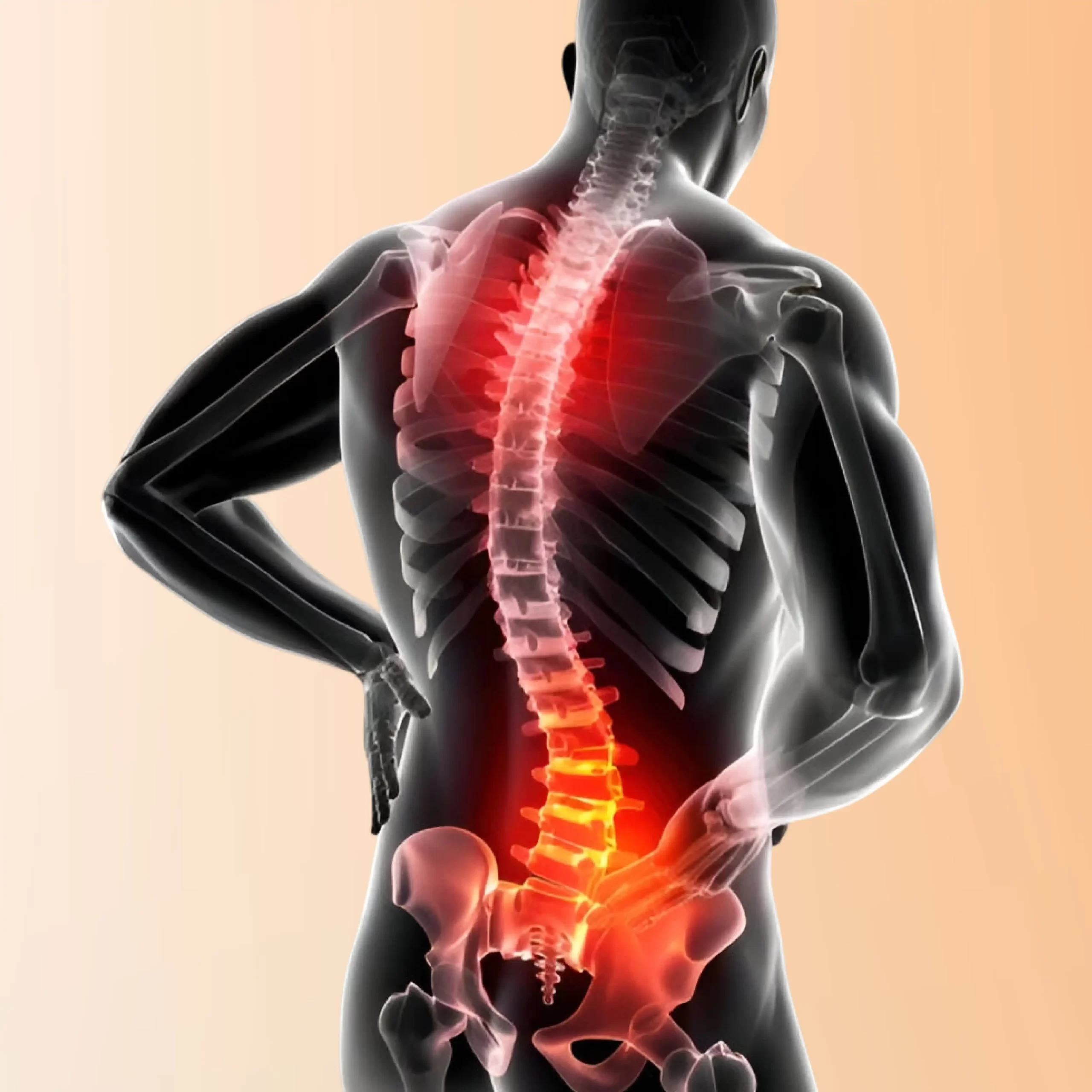 Scoliosis: Spinal Curvature Diagnosis and Treatment with Dr. Hazem