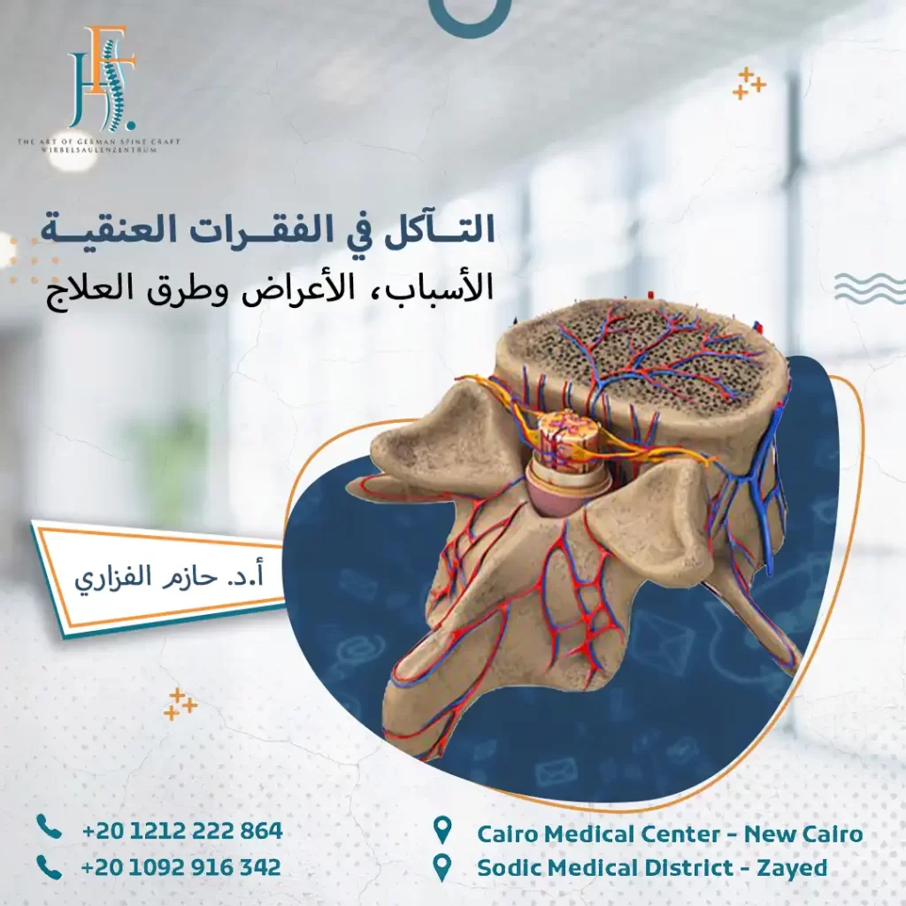 التآكل في الفقرات العنقية – الأسباب، الأعراض وطرق العلاج