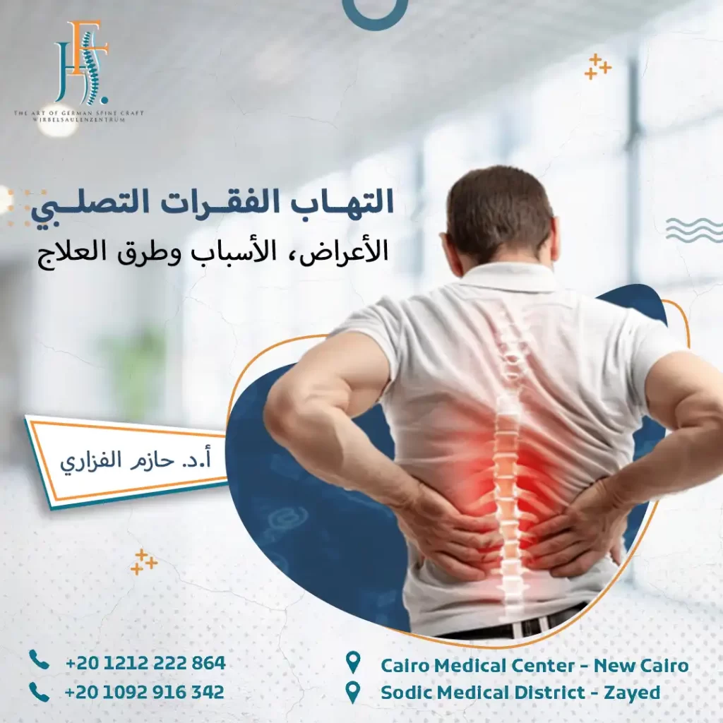 التهاب الفقرات التصلبي