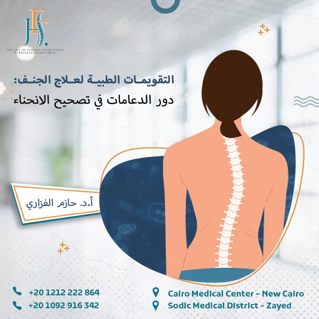 التقويمات الطبية لعلاج الجنف