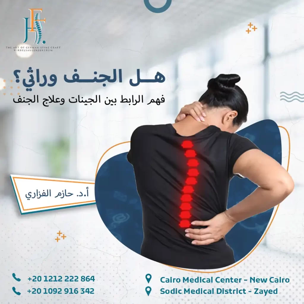 هل الجنف وراثي؟
