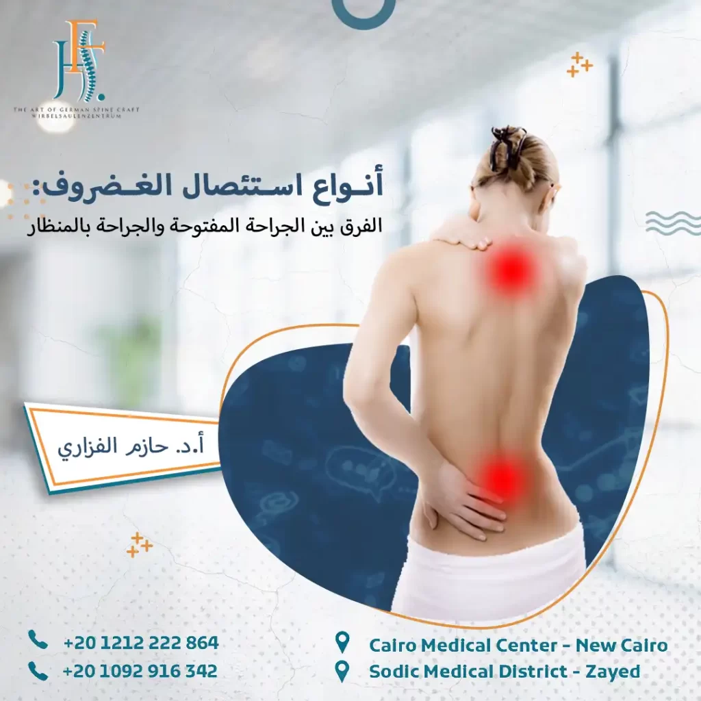 الفرق بين الجراحة المفتوحة والجراحة بالمنظار