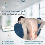 الجنف المراهق والجنف البالغ