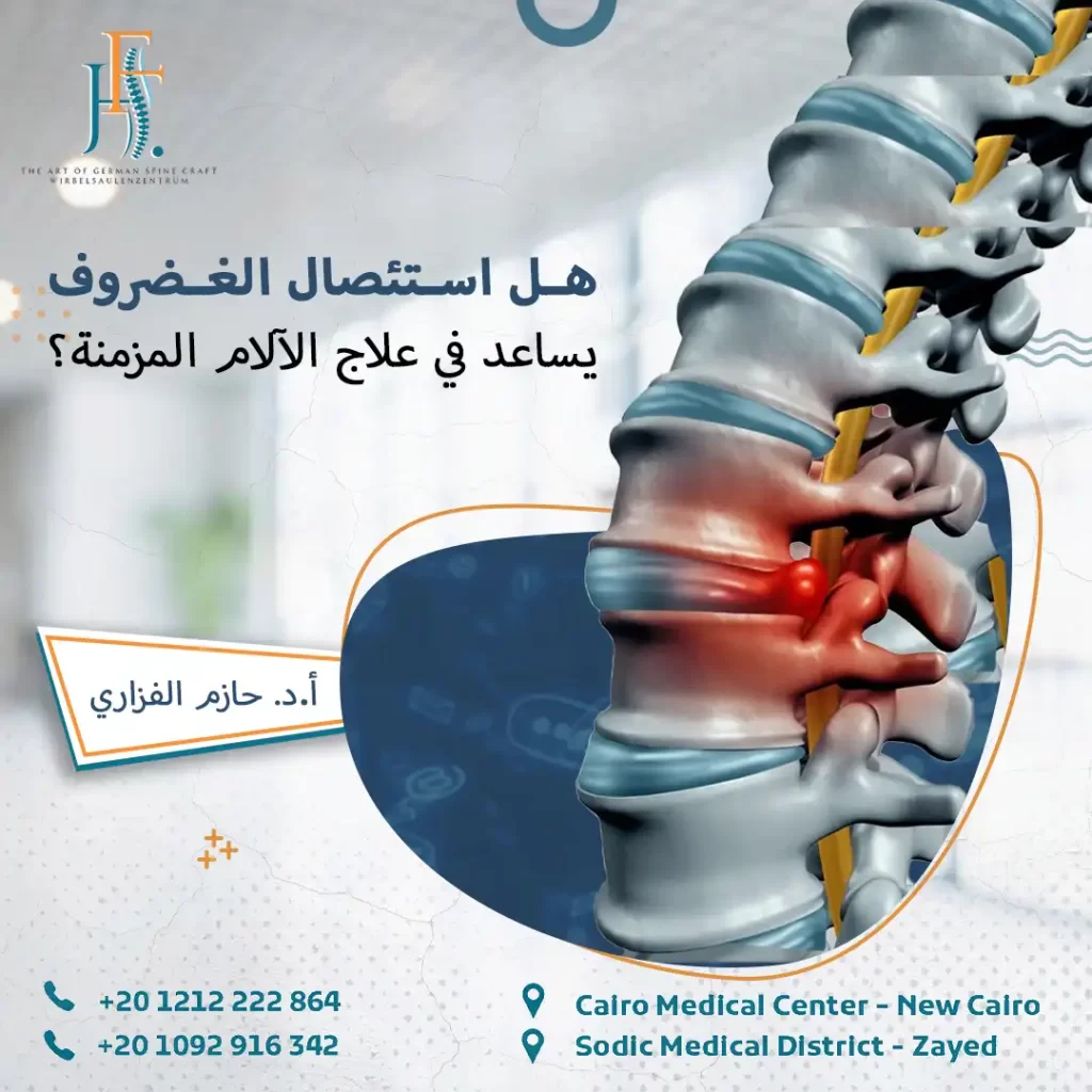 استئصال الغضروف لعلاج الآلام المزمنة