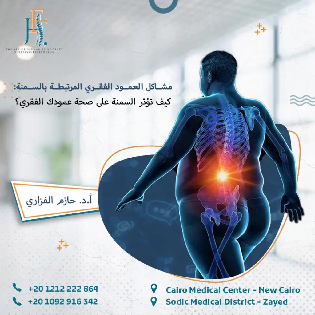 مشاكل العمود الفقري المرتبطة بالسمنة