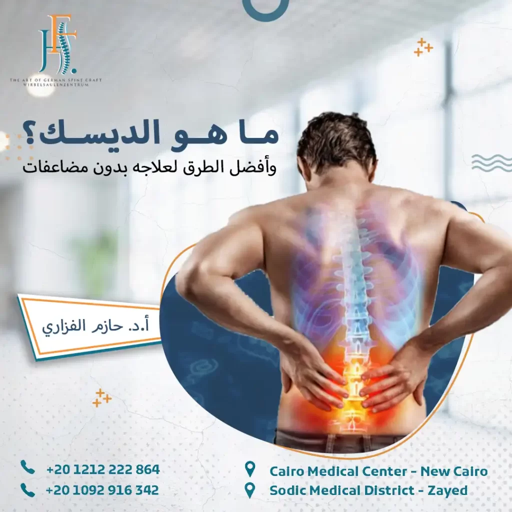 ما هو الديسك؟ وأفضل الطرق لعلاجه