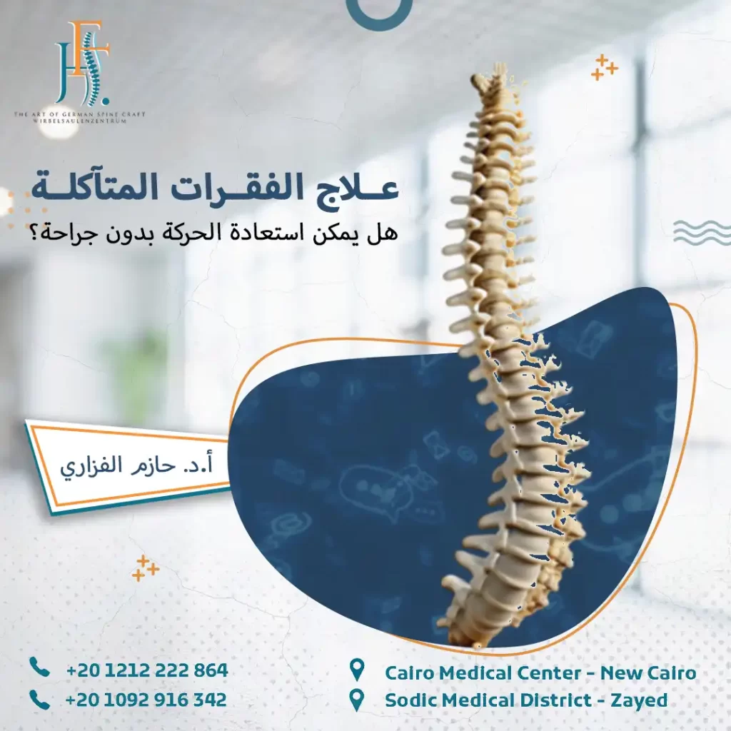 علاج الفقرات المتآكلة