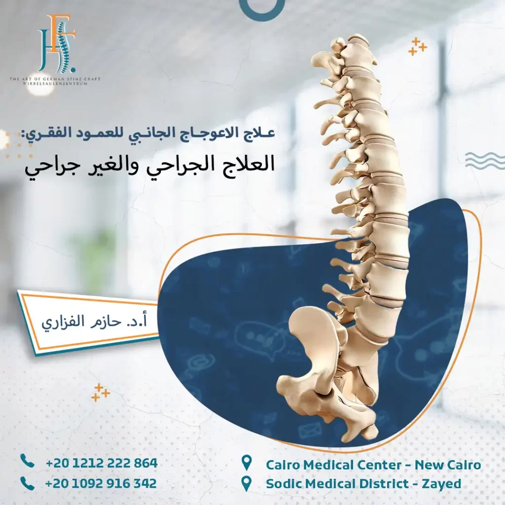 علاج الاعوجاج الجانبي للعمود الفقري