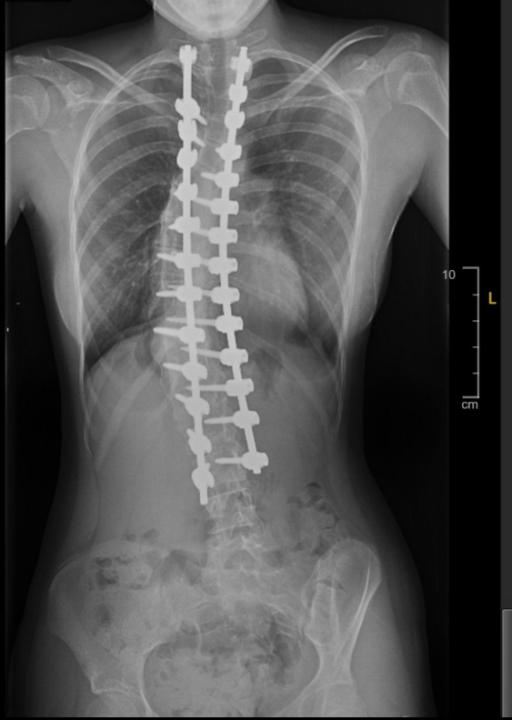 After treatment