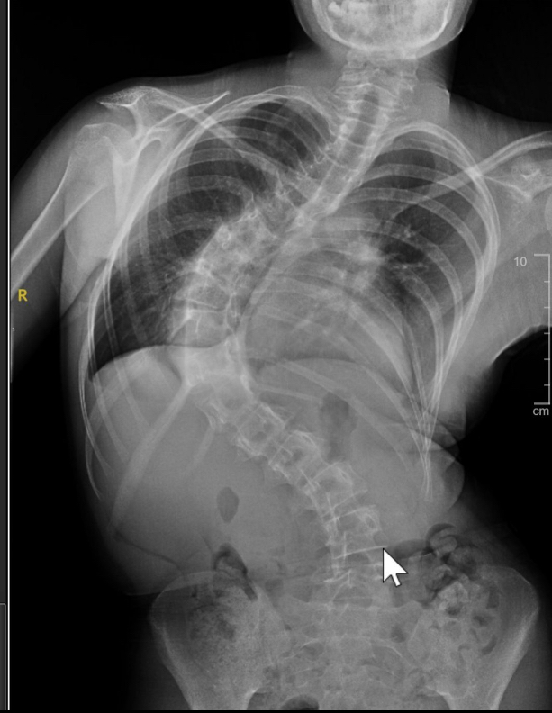 Before treatment