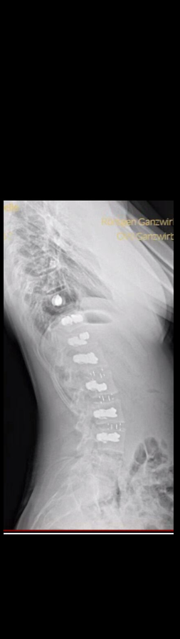 After treatment