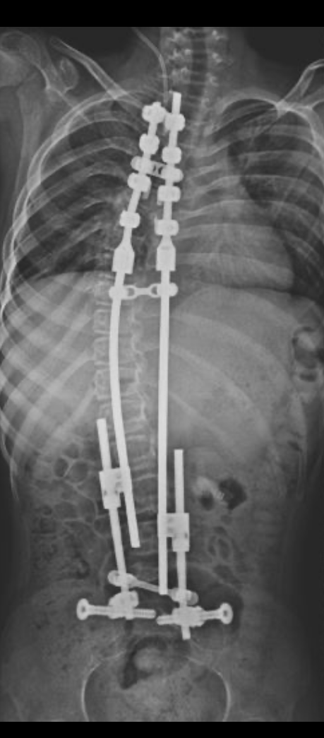 After treatment