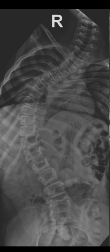 Before treatment