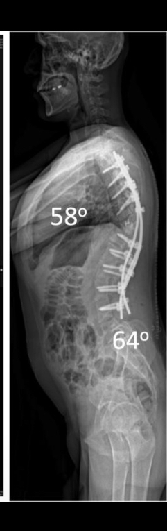 After treatment