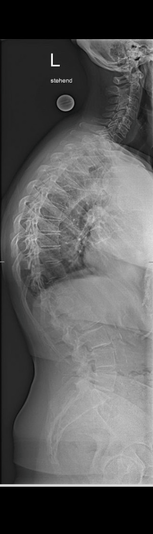 Before treatment