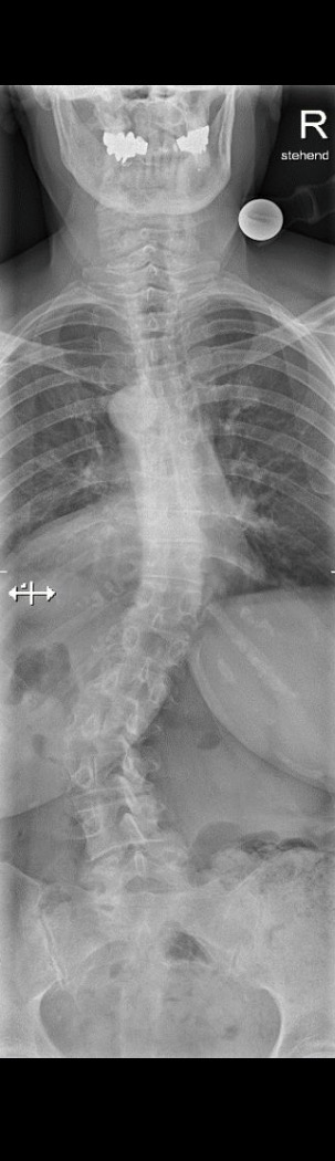 Before treatment