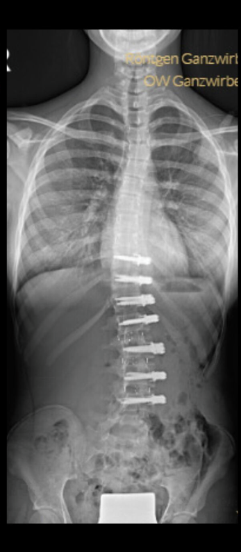 After treatment