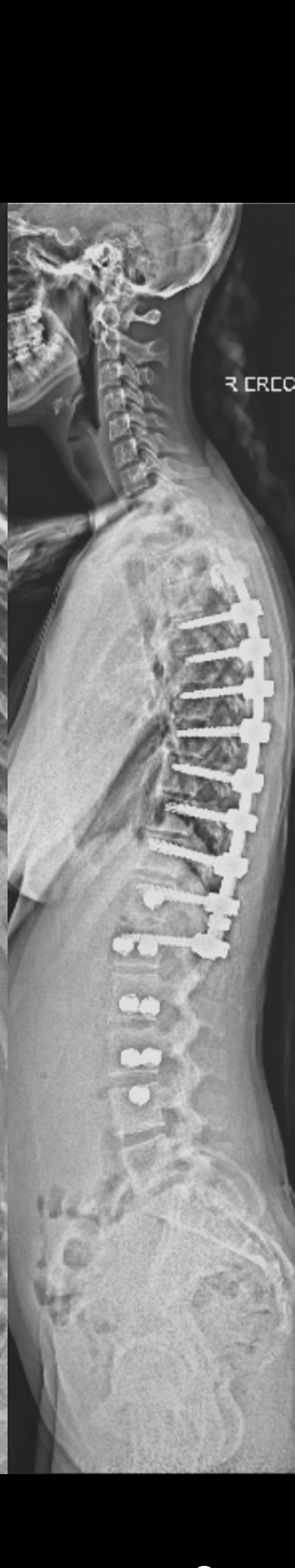 After treatment