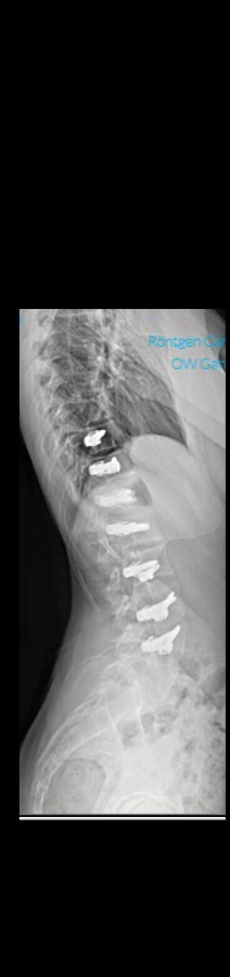 Before treatment