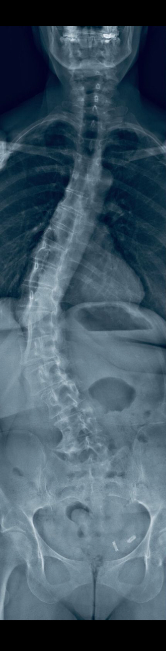 Before treatment