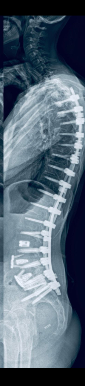 After treatment