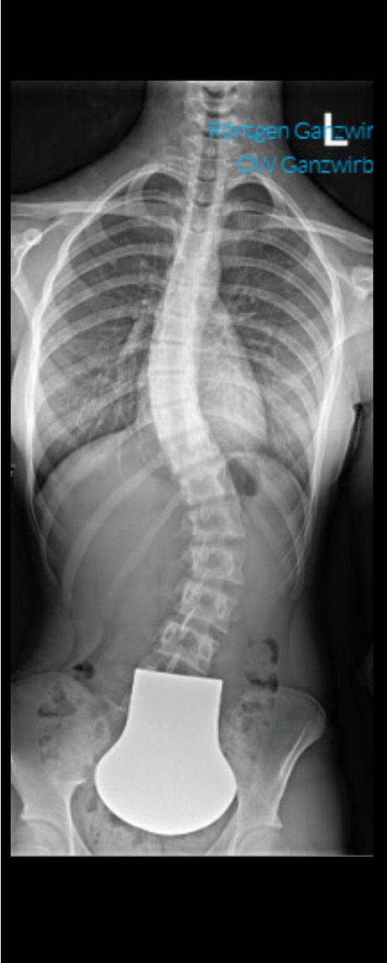 Before treatment
