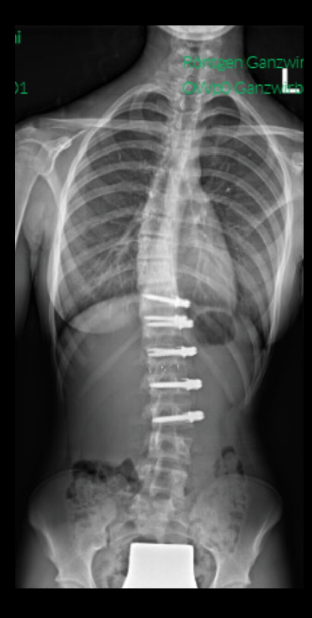 After treatment