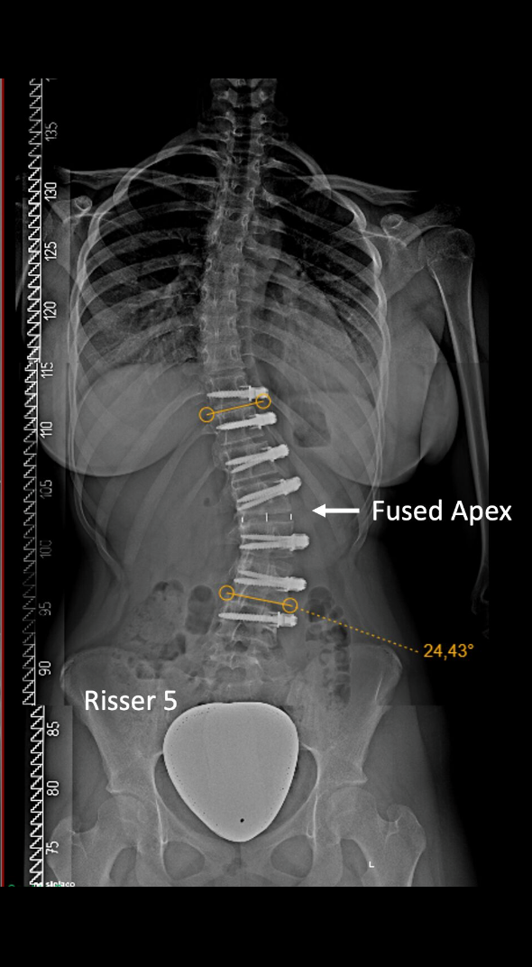 After treatment
