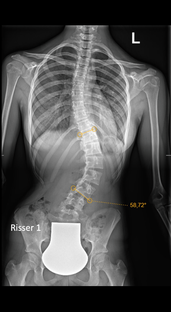 Before treatment