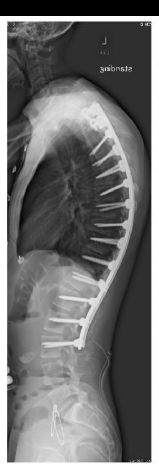 After treatment