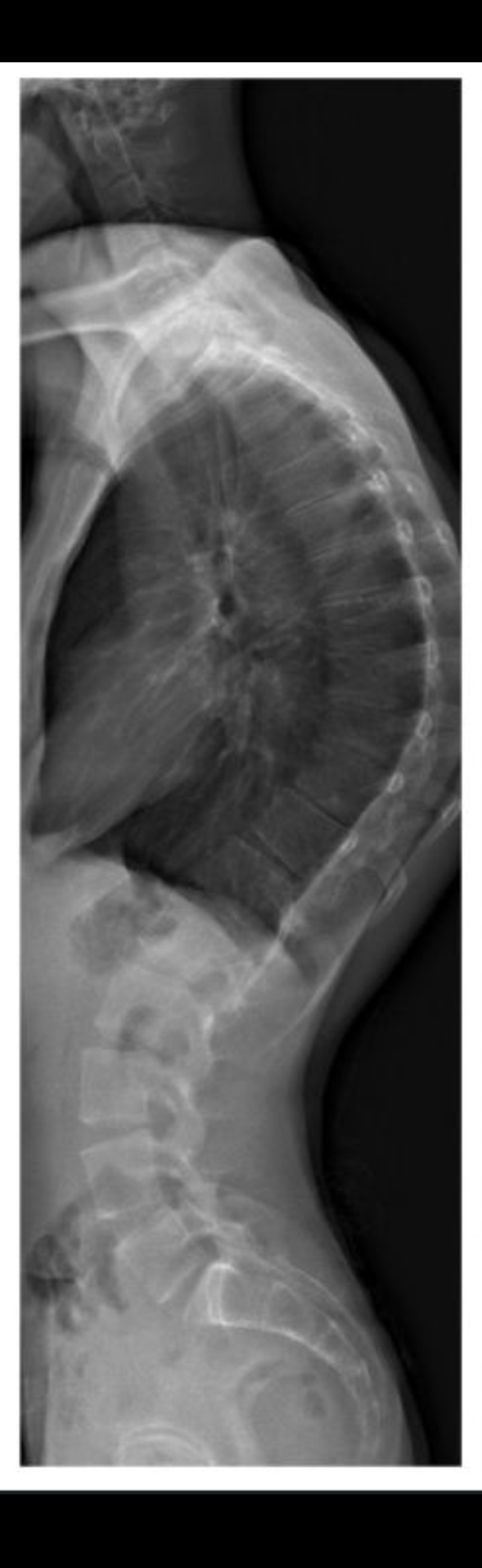 Before treatment